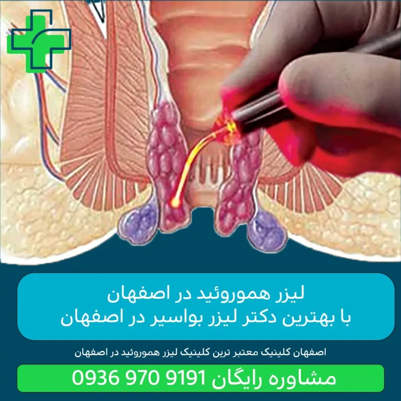 عمل بای پس معده در اصفهان عمل بای پس معده در اصفهان