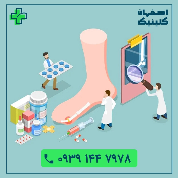 مرکز زخم پای دیابتی اصفهان زخم دیابتی در اصفهان