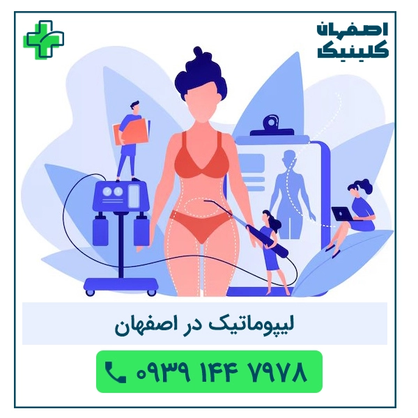 لیپوماتیک در اصفهان
