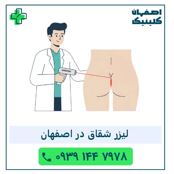 بهترین دکتر لیزر شقاق در اصفهان در سال 1405 | لیزر دائمی شقاق لیزر شقاق در اصفهان
